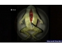 Скриншот 8: Silent Hill: Shattered Memories (PSP)